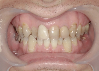 Before